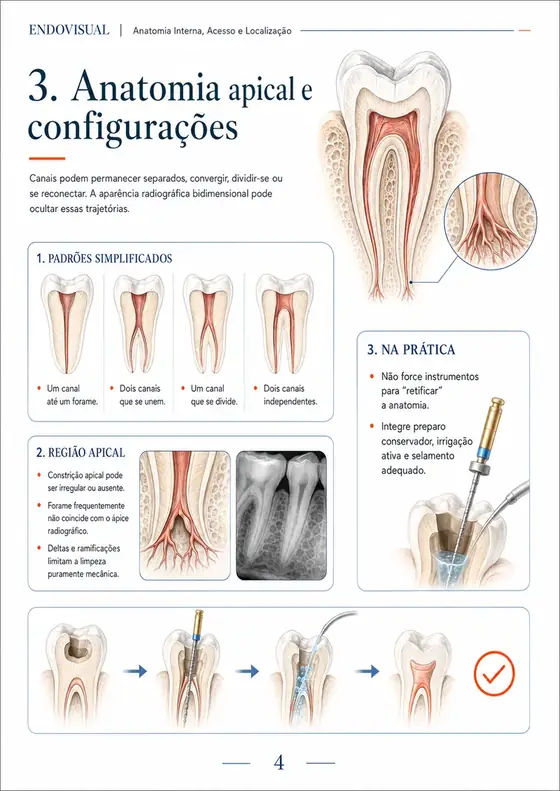 Ficha EndoVisual — Anatomia apical e configurações