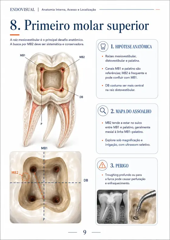 Ficha EndoVisual — Primeiro molar superior